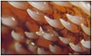 دندان اسبله